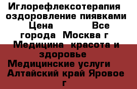 Иглорефлексотерапия, оздоровление пиявками › Цена ­ 3 000 - Все города, Москва г. Медицина, красота и здоровье » Медицинские услуги   . Алтайский край,Яровое г.